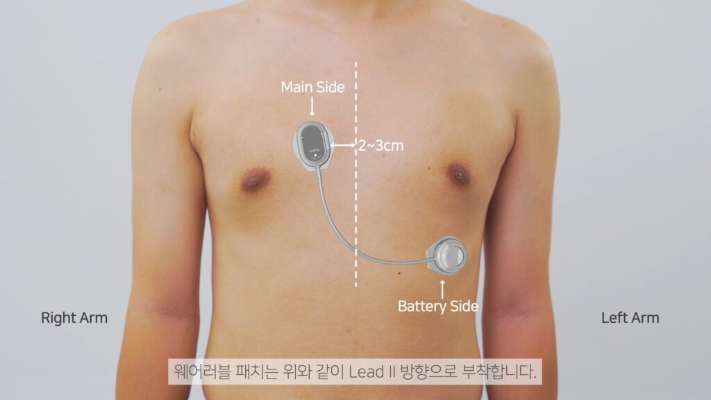 mobiCARE MC200M 웨어러블 심전도 패치 부착 위치 사용법